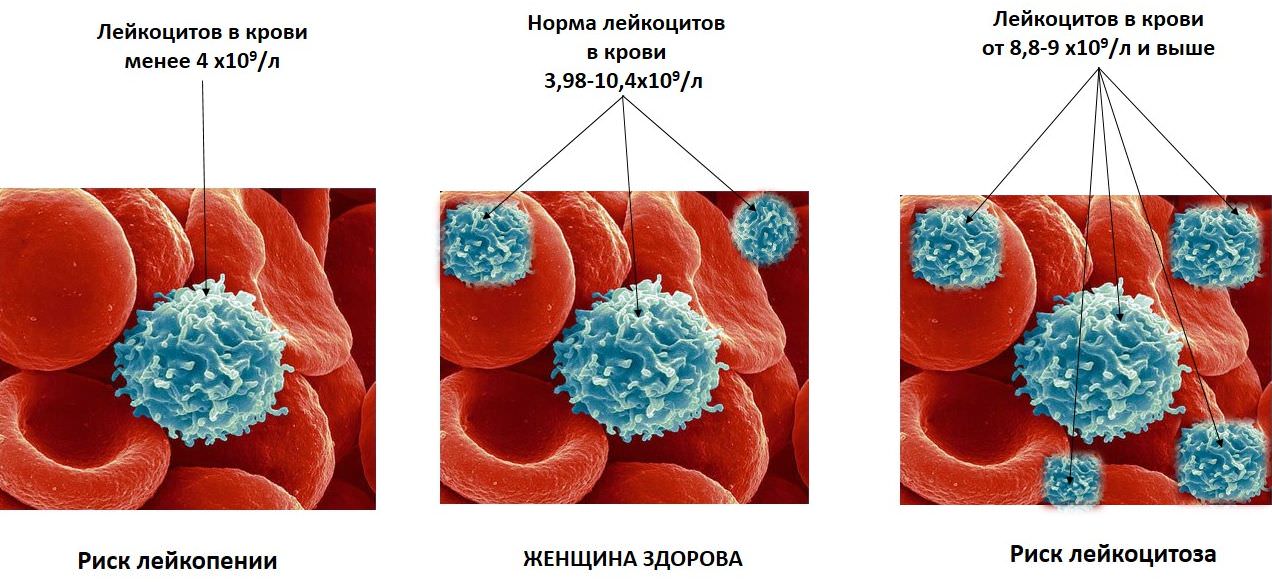 Количество лейкоцитов в крови у мужчин